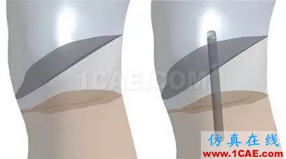 亞當沉浮錄--大都會藝術博物館的保管員邀請仿真專家幫助修復具有600年歷史的雕塑 美國仿真專家首次利用ANSYS協助修復破損的雕塑ansys培訓課程圖片6